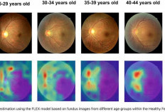 AI Ungkap Usia Retina Manusia Melalui Mata, Terobosan Baru dalam Kesehatan Reproduksi