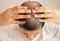 Obat Penurun Berat Badan Ini Diduga Memicu Kerontokan Rambut