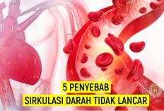  Lima Penyebab Sirkulasi Darah Tidak Lancar, Salah Satunya Penyakit Diabetes