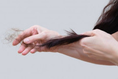 Lima Faktor Penyebab Rambut Rontok, Wanita Wajib Tahu!