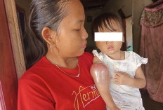 Bocah Pengidap Kanker Warga Desa Talang Tinggi Ulu Manna Butuh Bantuan Tuk Jalani Operasi