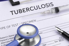 Pengidap TBC di Kaur Masih Tinggi, Tahun Ini Tercatat 24 Kasus Baru