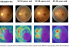 AI Ungkap Usia Retina Manusia Melalui Mata, Terobosan Baru dalam Kesehatan Reproduksi